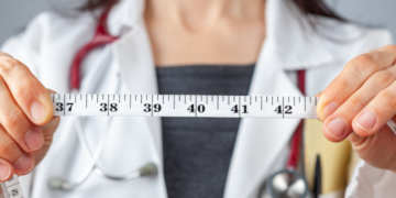 Chirurgia bariatrica: un passo importante per vivere meglio